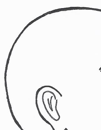 Orbicularis oculi lihas saattaa heijastaa kipua ja särkyä nenän sivustaan monenlaisten muiden oireiden lisäksi..